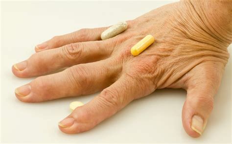 Artrita degetului cum să tratezi